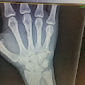 Meet your Posher, Ricky